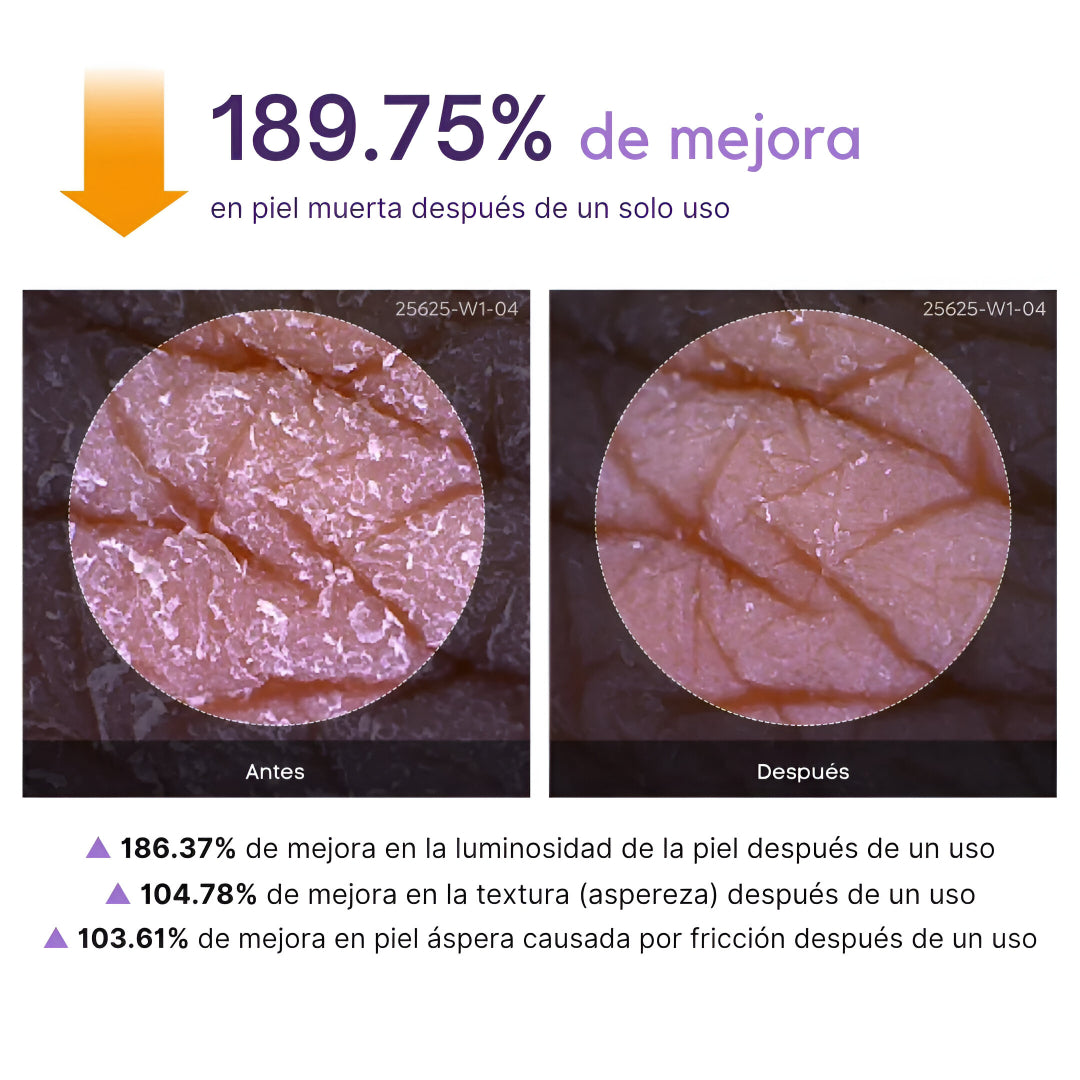 Zeyren™ - Spray aclara cualquier zona oscura