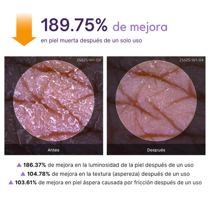 Zeyren™ - Spray aclara cualquier zona oscura